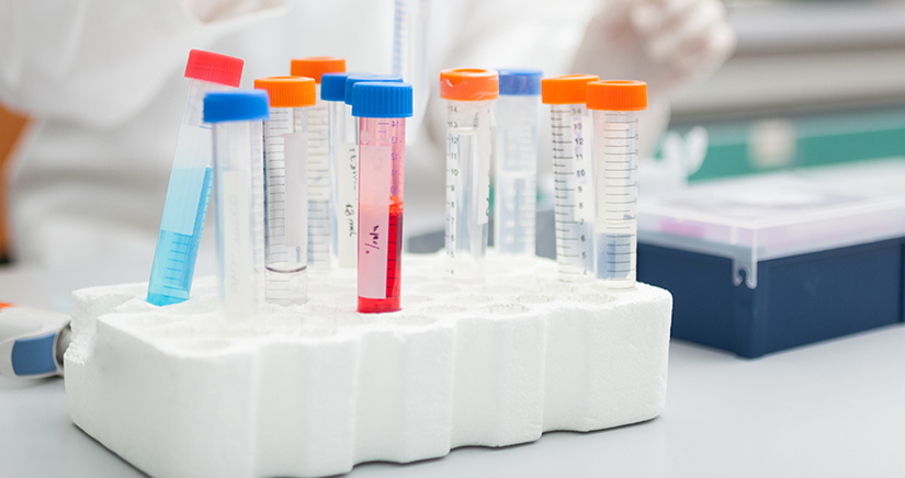 Bild Labor Probenbehälter