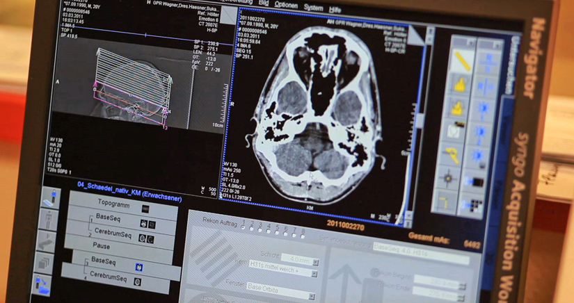 Bild Nuklearmedizin CT