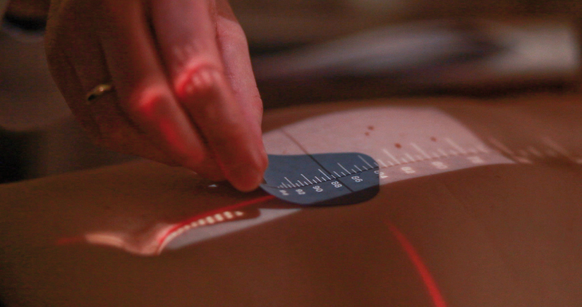 Bild Strahlentherapie Bestrahlung