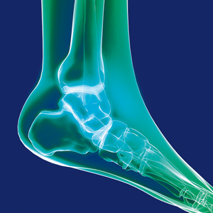 Bild Orthopädie Fuss Sprunggelenk
