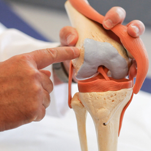 Bild Orthopädie Kniemodell