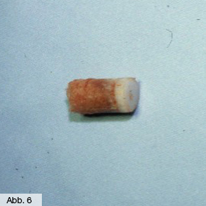 Bild Orthopädie Knorpel Stammzellknorpel