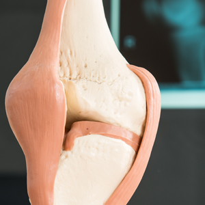 Bild Orthopädie Meniskus