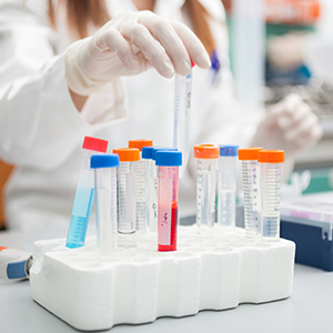 Bild Labor Reagenzgläser