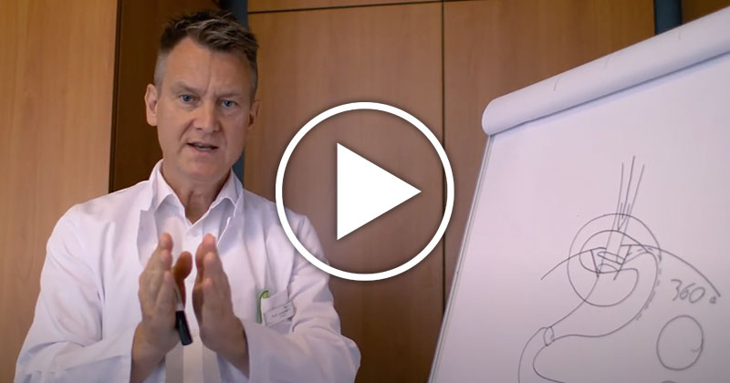 Externer Link: YouTube-Video Thema Reflux Teil 9 (Öffnet neues Fenster)